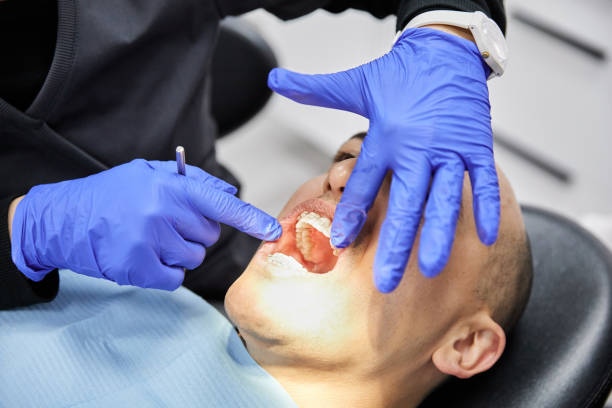 Best Emergency Wisdom Tooth Extraction in Warren, PA